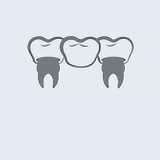 Несъемное протезирование